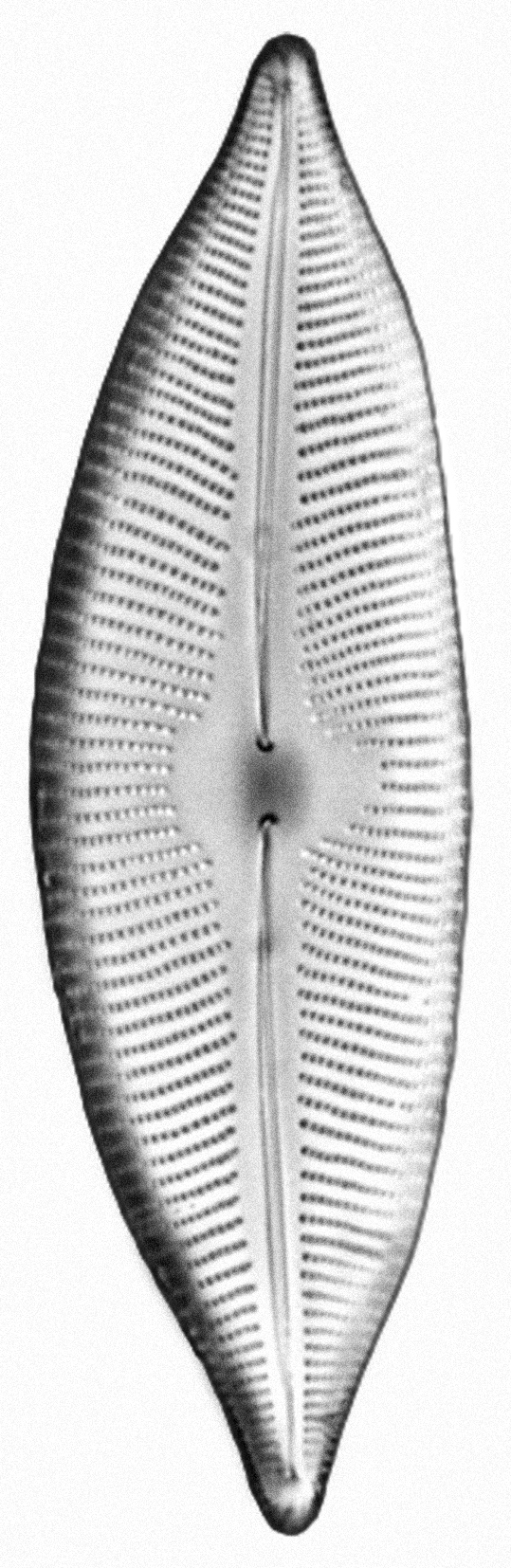 Dictyocha speculum